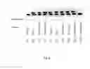 Fig. 09 - PROGRANULIN AS MARKER FOR AUTOIMMUNE DISORDERS