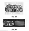 Fig. 25 - Methods and apparatus for phase correction in magnetic resonance imaging