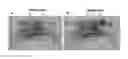 Fig. 01 - Deterministic phase correction and application