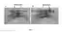 Fig. 02 - Deterministic phase correction and application