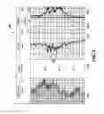 Fig. 04 - Method and system for density correction for geophysical well logging inside drilling rods