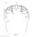 Fig. 05 - Utilizing pseudo-random patterns for eye tracking in augmented or virtual reality systems
