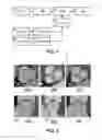 Fig. 02 - METHOD AND APPARATUS FOR SIMULATING BLOOD FLOW UNDER PATIENT-SPECIFIC BOUNDARY CONDITIONS DERIVED FROM AN ESTIMATED CARDIAC EJECTION OUTPUT