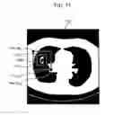 Fig. 72 - Control method of information terminal and computer-readable recording medium