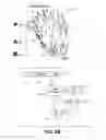 Fig. 04 - Method and system to automatically assign map points to anatomical segments and determine mechanical activation time