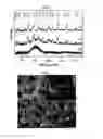 Fig. 02 - Method for forming a reduced graphene oxide/metal sulfide composite and its use as an anode for batteries
