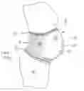 Fig. 01 - Maternity support garment