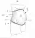 Fig. 02 - Maternity support garment