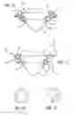 Fig. 09 - CONVERTIBLE SWIMSUIT AND METHOD FOR ASSEMBLING SAME