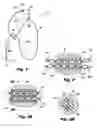 Fig. 02 - Adjustable jewelry