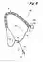 Fig. 05 - Adjustable jewelry