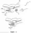 Fig. 05 - Jewellery with securely nested changeable decorative elements