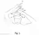 Fig. 06 - Towel cape and method