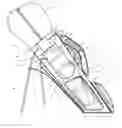 Fig. 01 - Golf bag hydration system and multi-accessory unit