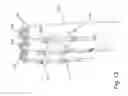 Fig. 14 - VEGETABLE GROWTH SUPPORT DEVICE