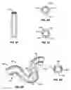 Fig. 06 - ACTIVATED POLYMER ARTICULATED INSTRUMENTS AND METHODS OF INSERTION