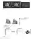 Fig. 03 - Estimating distribution, fluctuation and/or movement of electrical activity through a heart tissue