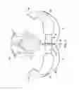 Fig. 03 - Labor management devices for pelvic floor support