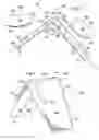 Fig. 04 - Labor management devices for pelvic floor support