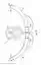 Fig. 15 - Labor management devices for pelvic floor support