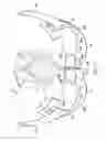 Fig. 16 - Labor management devices for pelvic floor support