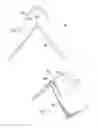 Fig. 17 - Labor management devices for pelvic floor support