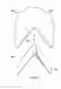 Fig. 19 - Labor management devices for pelvic floor support