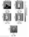 Fig. 15 - TORIC FOCUSING FOR RADIATION FORCE APPLICATIONS