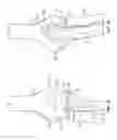 Fig. 02 - Patient-specific elbow guides and associated methods