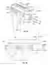 Fig. 09 - Patient-specific elbow guides and associated methods