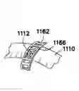 Fig. 01 - Multifunctional surgical access system
