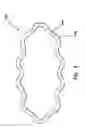 Fig. 04 - Multifunctional surgical access system