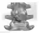 Fig. 01 - Lamina implant and method