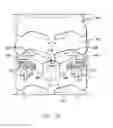 Fig. 03 - Lamina implant and method