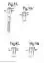 Fig. 16 - Dynamic spinal stabilization assemblies, tool set and method