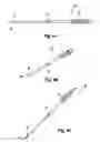 Fig. 07 - Cervical spine stabilization system with extendable plates