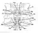 Fig. 01 - Spinal plate and drill guide