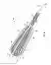 Fig. 03 - Apparatus and methods for fracture repair