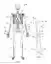 Fig. 05 - Apparatus and methods for fracture repair