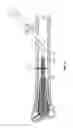 Fig. 16 - Apparatus and methods for fracture repair