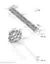 Fig. 31 - Apparatus and methods for fracture repair