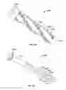 Fig. 40 - Apparatus and methods for fracture repair