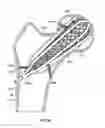 Fig. 47 - Apparatus and methods for fracture repair
