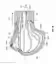 Fig. 48 - Apparatus and methods for fracture repair