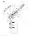 Fig. 05 - Hip fixation with load-controlled dynamization