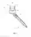 Fig. 08 - Bone fastener and methods of use