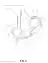 Fig. 07 - Operation handles for electrocautery