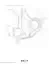 Fig. 10 - Operation handles for electrocautery