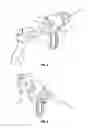 Fig. 03 - Partitioned surgical instrument