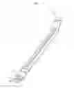Fig. 07 - Electrode sheath for electrosurgical device